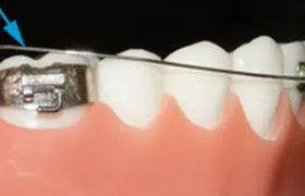 Loose Wire
